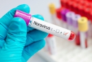 Adenovirusinė, norovirusinė ir rotavirusinė infekcijos